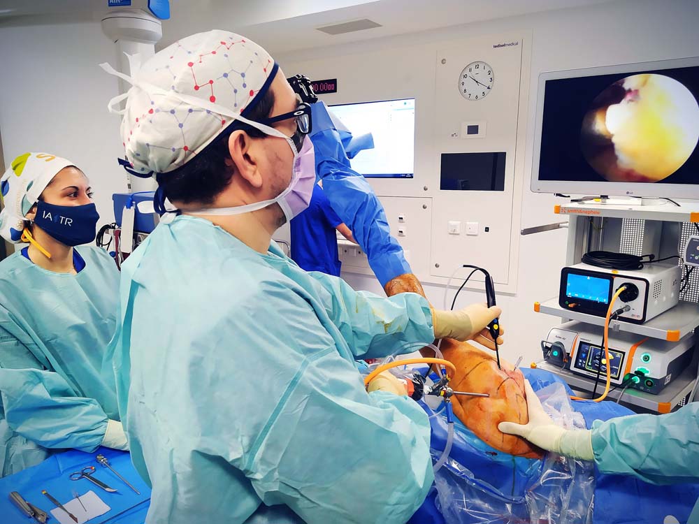 Artroscopia-de-hombro-Dr-Camacho